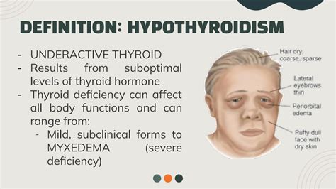 SOLUTION: Hypothyroidism and Myxedema Coma - Studypool