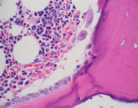 Osteoclasts being chased by osteoblasts! | KiKo XP