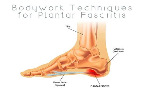 Bodywork Techniques for Plantar Fasciitis | Massage Professionals Update