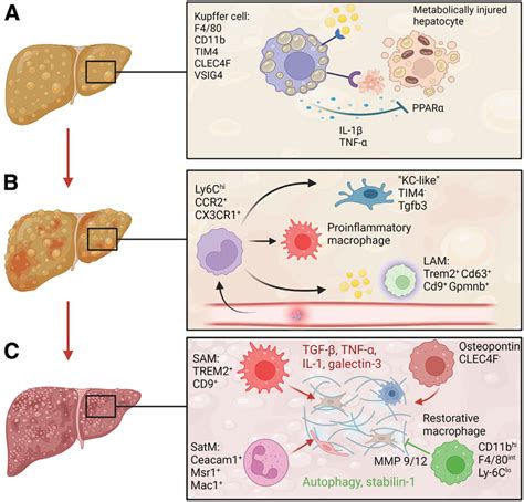 Macrophages foster progression from nonalcoholic fatty liver to NASH ...