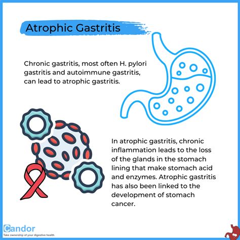 What are the Complications of Gastritis and Gastropathy? - Candor