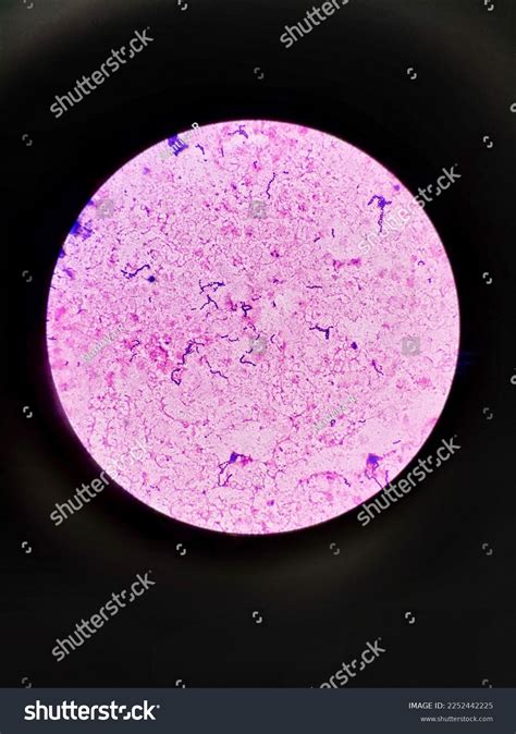 Streptococcus Pyogenes Gram Stain Picture Hemoculture Stock Photo ...