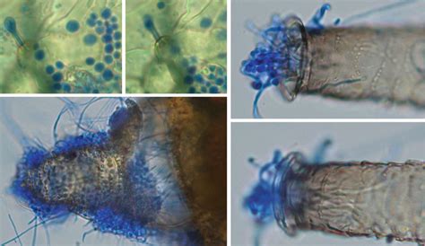 Light micrographs of the fungus Beauveria bassiana on the aphid host ...