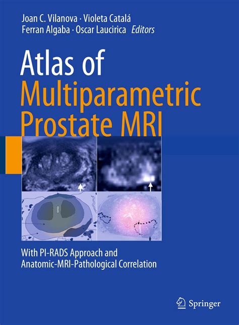 Calaméo - Atlas Of Multiparametric Prostate MRI With PI RADS Approach ...