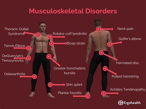 Managing Musculoskeletal Disorders at Work – Part One - Options HR ...