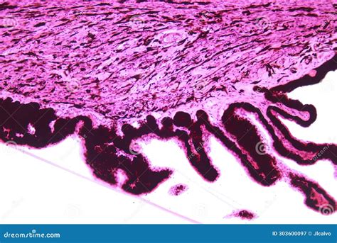 Human Eye. Ciliary Processes and Zonular Fibers Stock Image - Image of ...