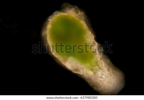 Difflugia Spprotozoa Under Microscope Stock Photo 637980385 | Shutterstock