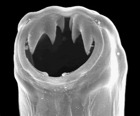 Hookworm Infection (Ancylostomiasis): Morphology, Life Cycle And ...