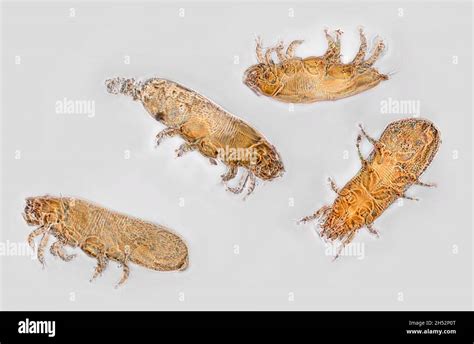 Acari mites from a rat. Phase contrast illumination, photomicrograph ...