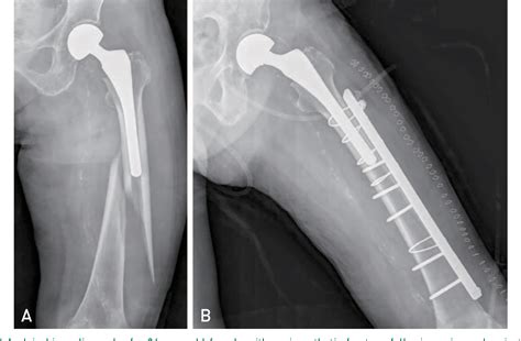 Figure 3 from Could Patient Undergwent Surgical Treatment for ...