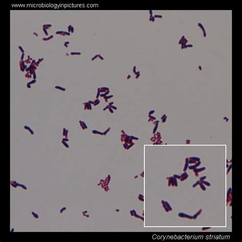 Corynebacterium striatum microscopy. Diphtheroids Gram-stained and cell ...