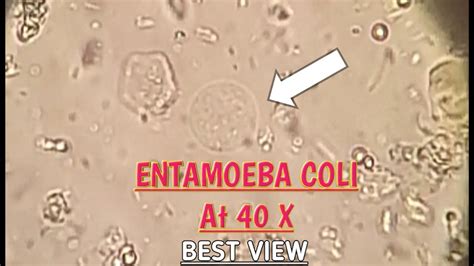 E coli under microscope 4x 232005