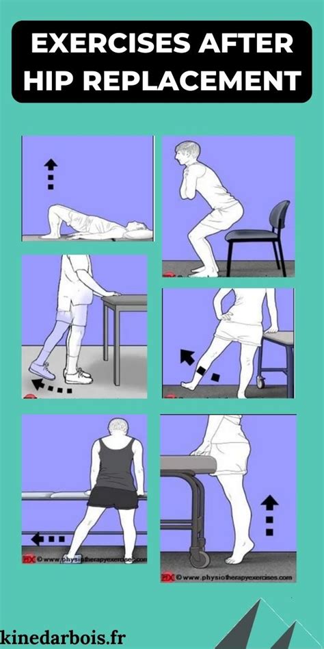 Physical Therapy After Hip Replacement Surgery: Guide & Tips!