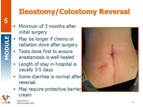 Stoma Savvy Fraser Health Regional Wound Education Regional