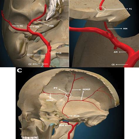 (PDF) Anatomy of the Middle Meningeal Artery