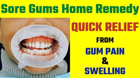 Sore Gums Home Remedy | Quick Relief From Gum Pain and Swelling | 5 ...