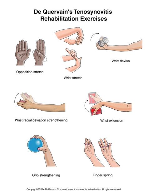 Pin on PHYSIO UPPERLIMBS