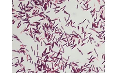 Bacillus Cereus Simple Stain