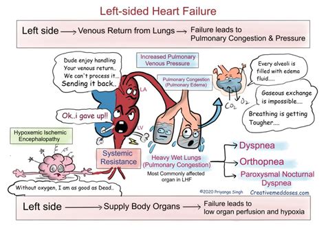 Heart Failure: Left sided VS Right sided - Creative Med Doses