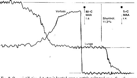 Figure 2 from Arteriovenous Shunts in Primary Varicosis? A Critical ...