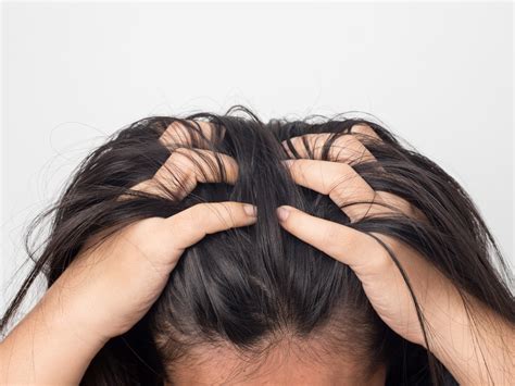 Top 5 Triggers Of Scalp Psoriasis – Balmonds