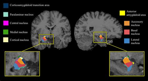 Amygdala And Hypothalamus Mri