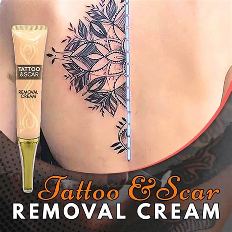 Best Tattoo Removal Creams Reviewed in 2024 - Tattify