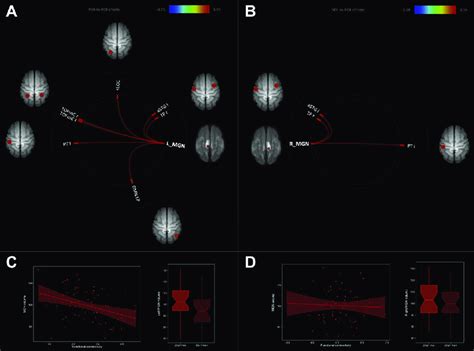 Functional connectivity (FC) of the medial geniculate nucleus (MGN ...