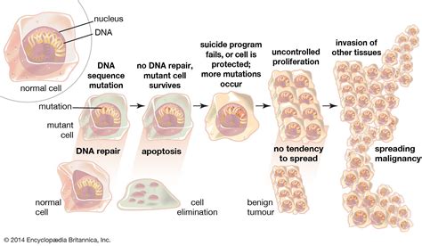 Benign tumour | pathology | Britannica