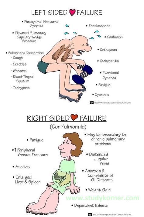 Nursing Left Sided Heart Failure - StudyPK