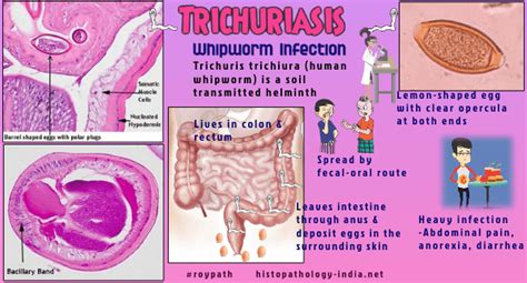 Rectal Prolapse Trichuris