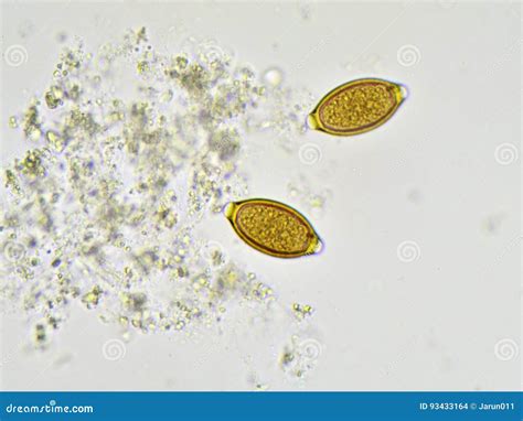 Trichuris Trichiura Royalty-Free Stock Photography | CartoonDealer.com ...