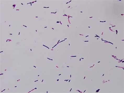 Bacillus Cereus Simple Stain