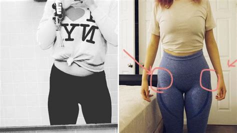 'Hip dips' are the latest Instagram body trend