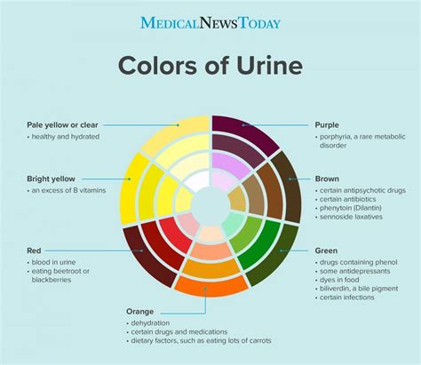 Bright yellow urine: Colors, changes, and causes | Color of urine ...