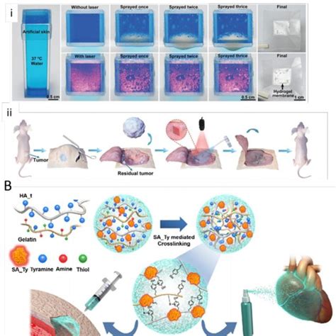 Injectable hydrogel systems and their applications. | Download ...