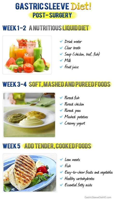 Pre Op Gastric Sleeve Diet Recipes - dietjulc