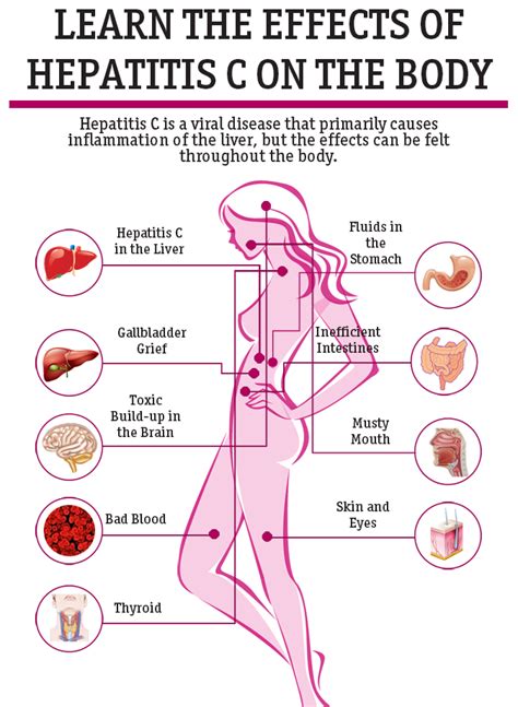 Hepatitis C Symptoms : Diagnosis, Treatment & Cure