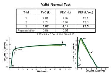 Spirometry Normal Values Chart