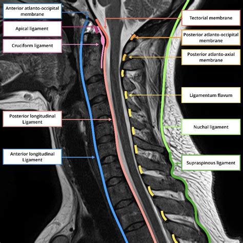 Pin by Mourad Salama on Head And Neck | Medical radiography, Radiology ...