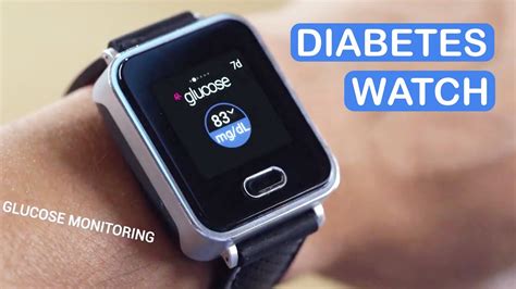 K Watch Glucose | Smartwatch Mede Diabetes SEM PICADAS - YouTube