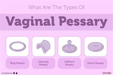 Vaginal Pessary: Causes, Symptoms, Treatment and Cost