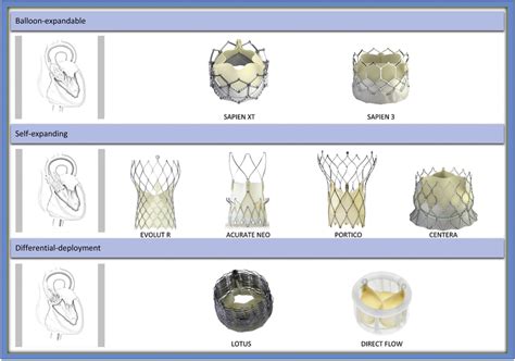 Transfemoral TAVI devices. Pictures provided courtesy of Edwards ...