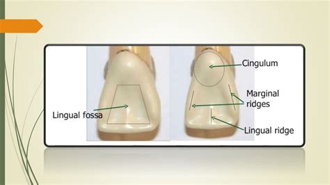 Maxillary central incisor (ORAL ANATOMY)