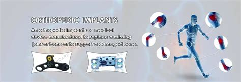 Orthopedic Implants Manufacturer, Supplier & Exporter in India