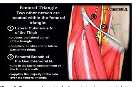 Figure 2 from femoral triangle anatomy review surgical application and ...