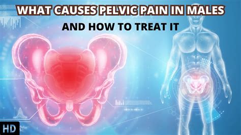 Chronic Pelvic Pain: Causes, Characteristics Treatment, 48% OFF