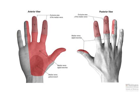 Common Palmar Digital Nerve | Median nerve, Nerve inflammation, Carpal ...