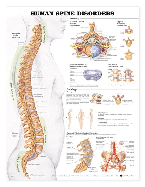 Human Spine Disorders - Charts | 2422