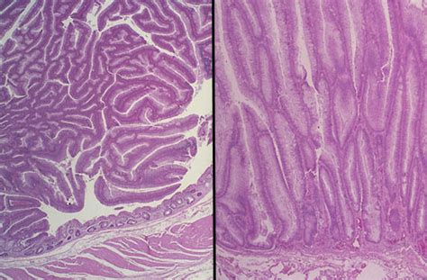 Gastrointestinal Pathology